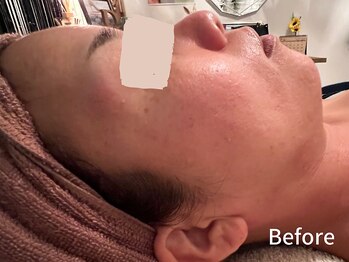 ダイヤモンド リーエンダ(Diamond leende)/クレイハーブピーリング