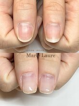 マリーロール 梅田店(Marie Laure)/自爪育成/深爪矯正/ネイルケア
