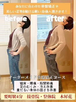木犀花/オーダーメイド骨盤矯正