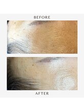 マーク(mark.)/即効果を実感！