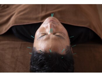 ココロ(CoCoLo)/ビフォーアフター