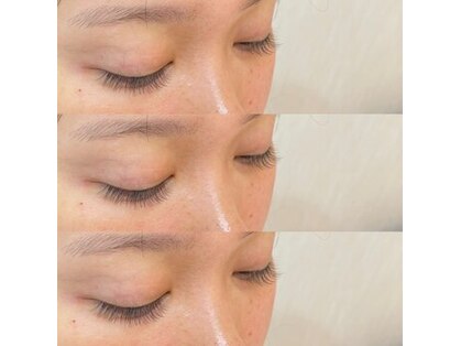 シアミス(SIAMIHS)の写真