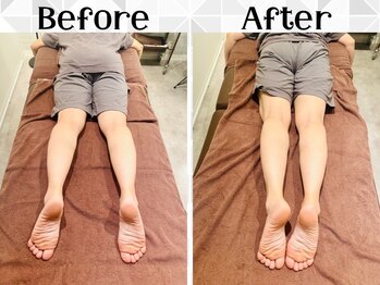 リストアハート(Restore Heart)の写真/毎日の忙しさで歪んだ体を取り戻す【Restore Heart】の美容整体・骨盤矯正！美ボディキープに必須技術！
