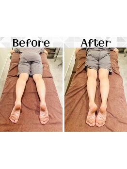 体の歪みをとりたい