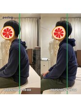 グレフル鍼灸接骨院 整体院 心斎橋/整体/肩こり/マッサージ/腰痛