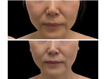 ルミエル バイ セリカ(Lumiere by SERIKA.)の雰囲気（肌年齢に差がつくトリートメント）