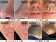 スキンジム(SKIN GYM)の写真
