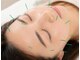 大津美咲野整骨院の写真