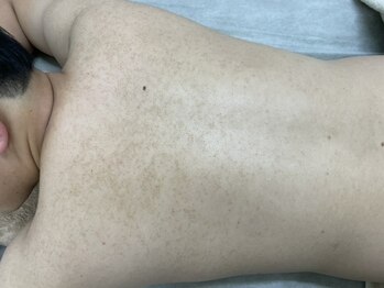 ナノハナ/鹿沼市の全身脱毛美容室ナノハナ