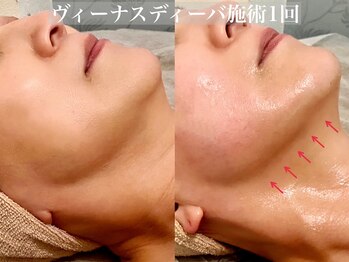 銀座ナチュラルスタイル/フェイシャルヴィーナスディーバ