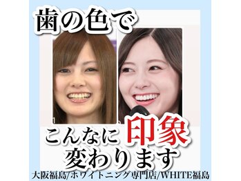 ホワイトニングサロン ホワイト(WHITE)/セルフホワイトニング/大阪/福島