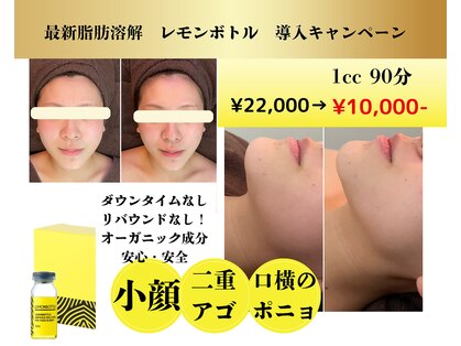 キサラ(Kisara)の写真