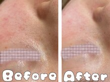 グラシア 倉敷店(Gracia)/お客様の施術事例