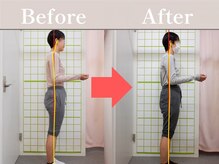やわた姿勢整体院/25歳女性