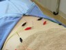【再来】あなただけのオーダーメイド施術♪　鍼灸＋整体コース