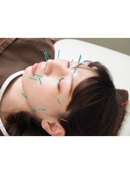 鍼灸施術を受けたい