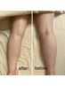 【上半身or下半身集中ケア】ラジオ波ボディ＋ハンド筋膜リリース60分