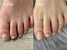 爪のいろは/足爪のイメチェンしませんか♪