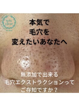 アロマアンドビューティー クリスタルローズ(CRYSTAL ROSE)/毛穴エクストラクション