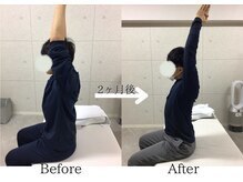 ライフタイムビューティー 江坂店(Life Time Beauty)の雰囲気（２ヶ月でこの結果！　月2回のストレッチで肩こり改善！！）