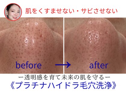 コタ(COTA)の写真