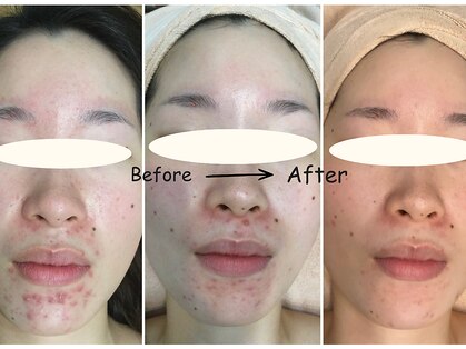 サニーハンド(Sunnyhand)の写真