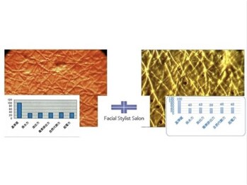 フェイシャルスタイリストサロン 四谷店/ケア例(58)