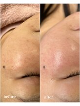 リル バイ ジャックインザボックス(rir by JACK-IN-THE-BOX)/