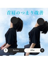まこと整体院 新鳥栖店/首の詰まり感がある方