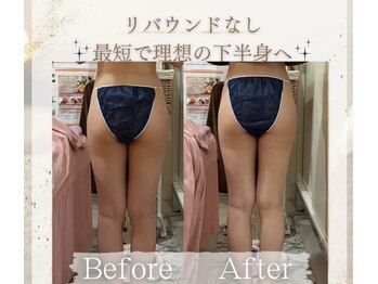 ラフィール/美脚：美尻になりたい