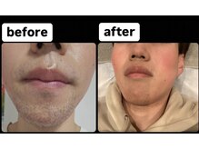 ゴッド(GOD)/ビフォーアフター