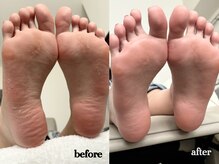 レア(rea)の雰囲気（《足裏角質除去フットケア》ガサガサかかと、足裏卒業♪）