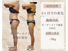 サロン ド ボーテ ラーンジュ 岐阜店(salon de beaut'e L'ange)/ハイパ-ナイフEX2ダイエット痩身