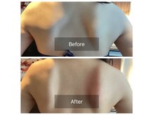 魅せる後ろ姿◎背中美人を骨格筋肉から創る肩甲骨はがし♪大宮店