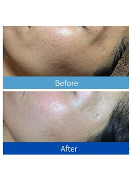 エクラ アン(eclat.un)/ダクトピール　女性