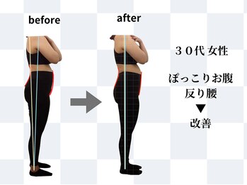 天白はら整体院アクト/骨盤矯正/肋骨引き締め/痩身