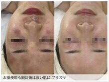 サロン ド ボーテ シャルル(Chaleureux)の雰囲気（【赤み痒み皮向け】二人三脚で、今ではゆらがないツヤ肌は）
