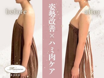ロココ 北千住店(Rococo)の写真/バストアップしながら同時に理想のスタイルへ♪痩身効果◎姿勢を改善して自分に自信が持てるボディに!
