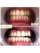 ルブラン 奈良店(Le Blanc)/ピアノの鍵盤かと思ったと