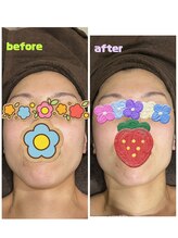 ギャラクシービューティー(galaxy beauty)/つやつやお肌に！