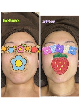 ギャラクシービューティー(galaxy beauty)/つやつやお肌に！