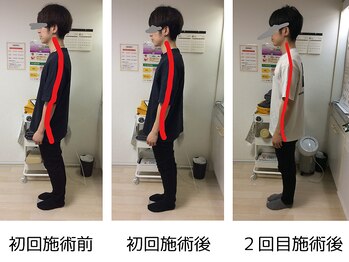 ストラボ 横浜店/ビフォーアフター７