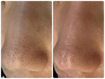 サイセイ(SAISEI)/