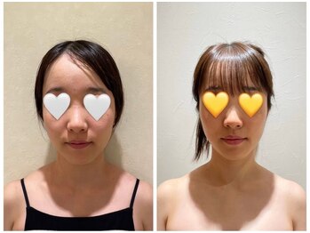 パルティール 新宿東口店 partir/パスリルリュクス