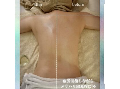 プルメリア(Plumeria)の写真