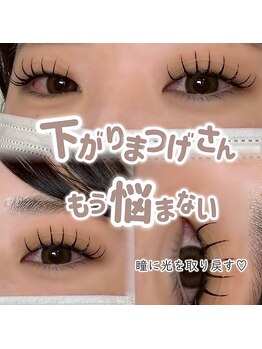 アルレ(ALRE)/Wフラット100