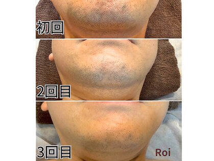 ロイ(ROI)の写真