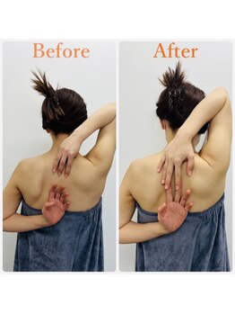 メディカルサロンドオフ 堺東店(medical salon de off)/リリースカッター