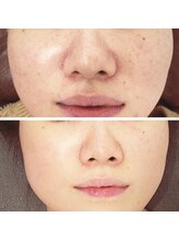 ジーニー(Genie)/あなたの未来は？