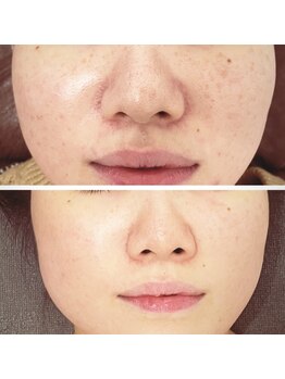 ジーニー(Genie)/あなたの未来は？